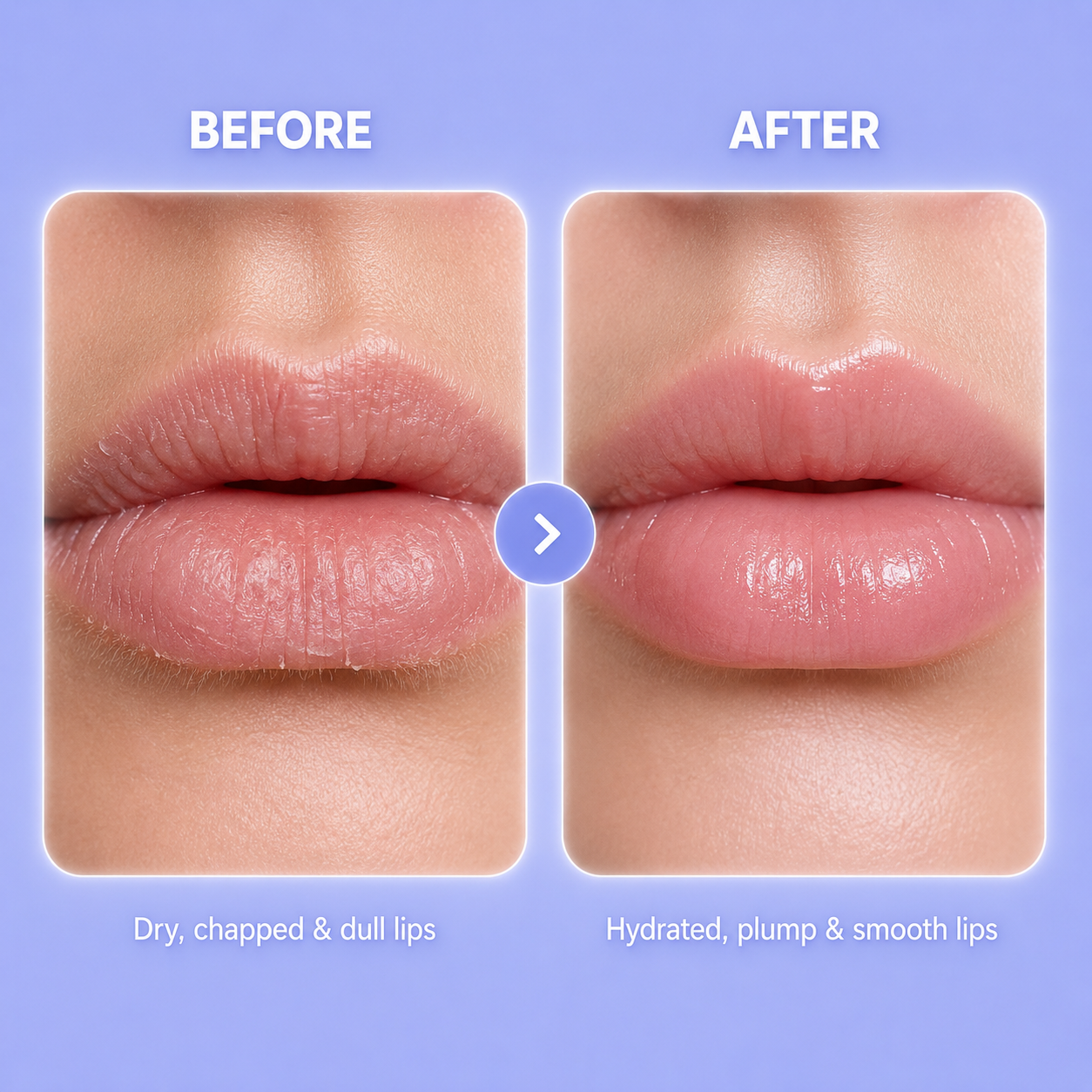 KISS ME KIT: Lip Plumping Roller + Hyaluronic Serum (FREE)