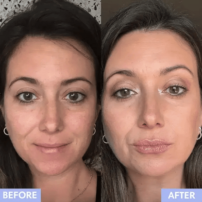 KISS ME KIT: Lip Plumping Roller + Hyaluronic Serum (FREE)